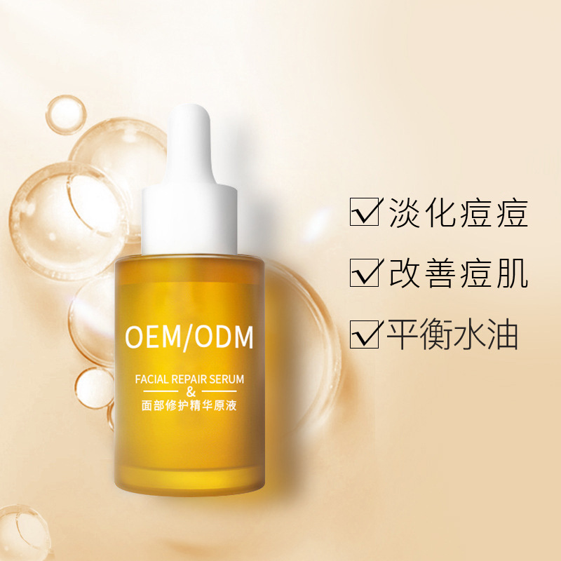周口市_祛痘精华原液OEM